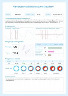 Fotopletysmografické vyšetření cév - dobrý výsledek
