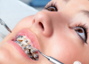 Součástí konference InDent 2016 bude program pro ortodontisty